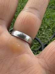Vintage Military Medical Service Class Ring