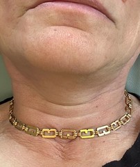 Vintage GIVENCHY 1980s GoldT plated GG Logo Chain Link Choker Necklace 16″